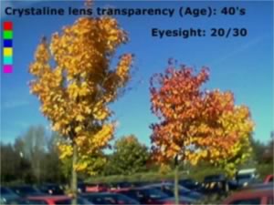 colour photo simulating age effects at 40